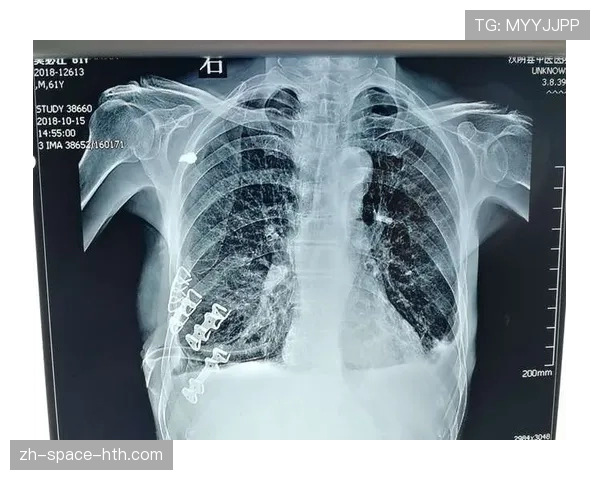 弗鲁姆2025年训练事故：肋骨骨折、腰椎骨折、气胸、心包破裂网页
